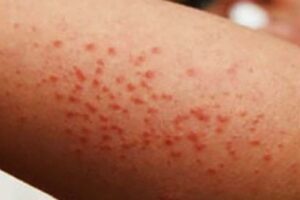 WhatsApp Image 2025-11-04 at 10.33.56