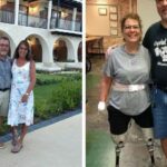 Mujer pierde brazos y piernas tras infección causada por su perro: “fue el peor día de mi vida”